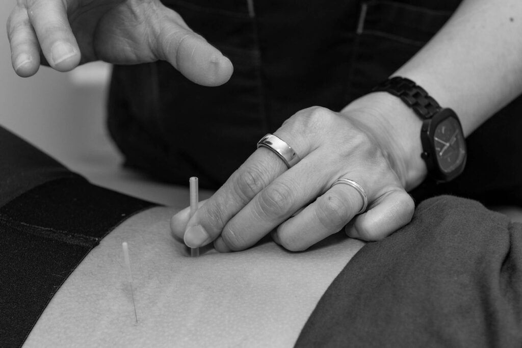 Rumiko Working LED Light Therapy Service, acupuncture