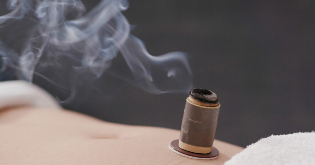 Moxibustion and Moxa